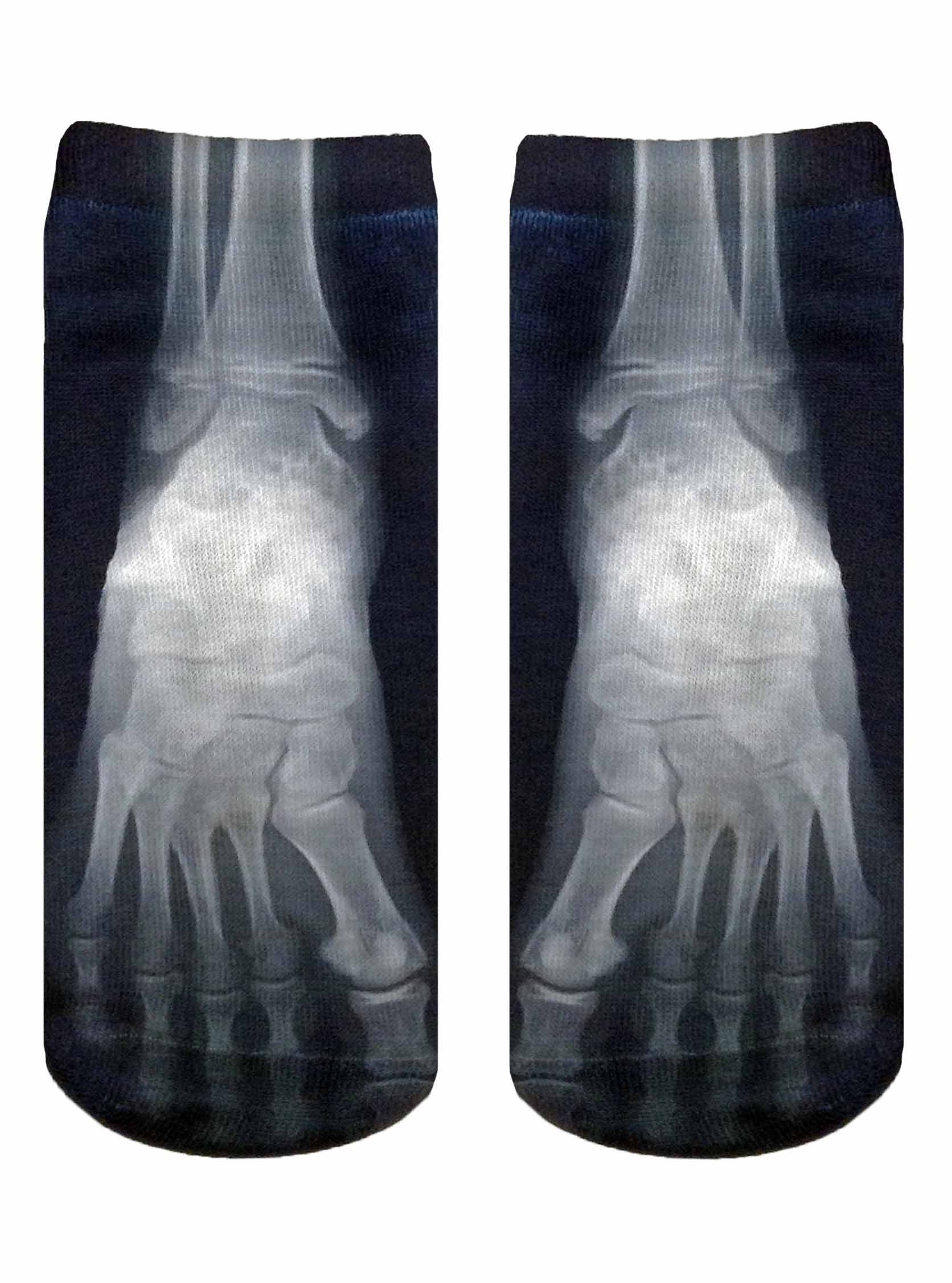 Picture of X Ray Ankle